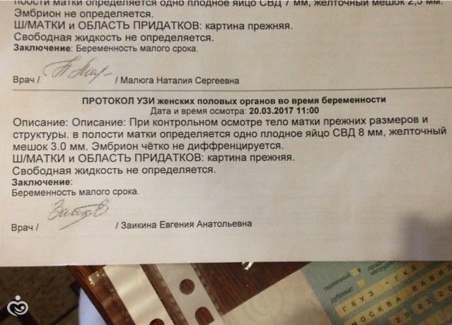 Муж не хочет беременную 93