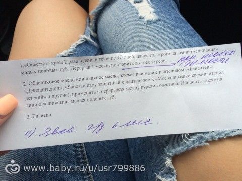 Синехии малых губ с большими Синехии малых губ с большими