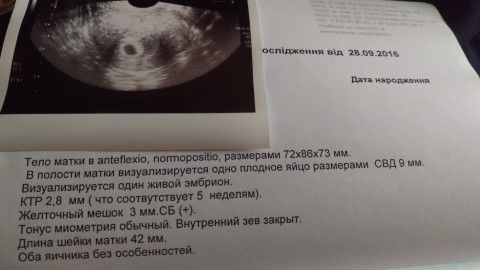 Как понизить уровень кортизола без лекарств Блог Идеальные роды практические рекомендации - часть 1