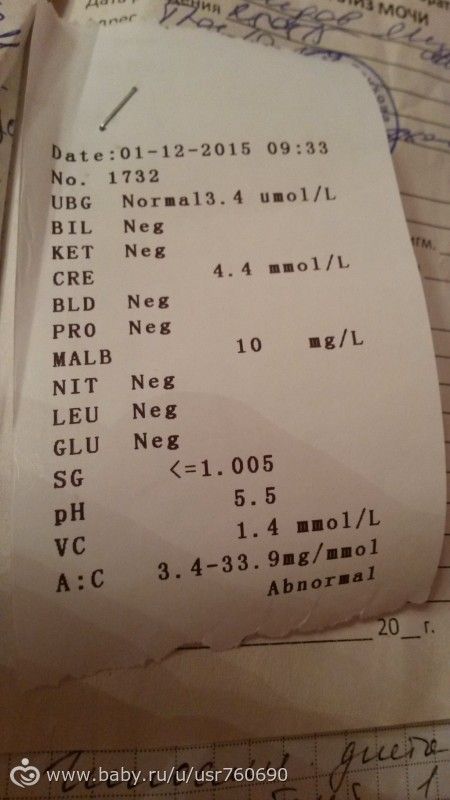 Анализ мочи pro 10 mgcl