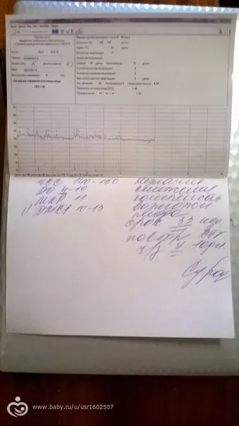 Плохое КТГ((((((