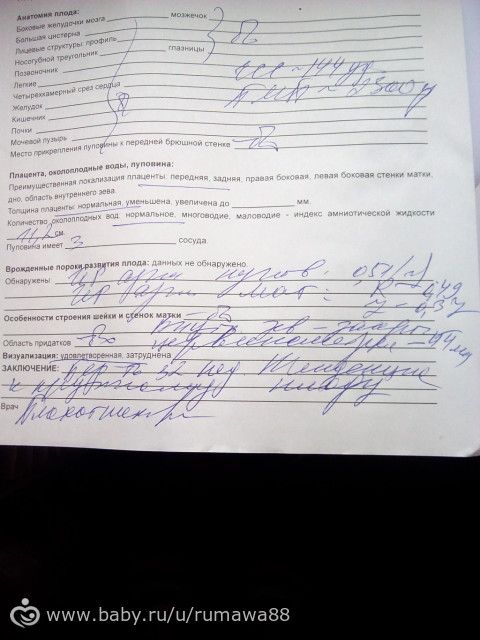 УЗИ 32 недели.