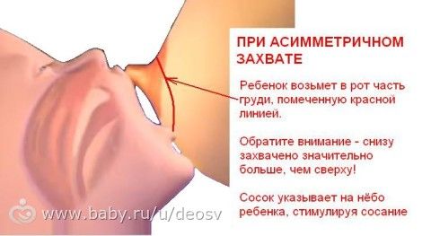 фото большие ореолы