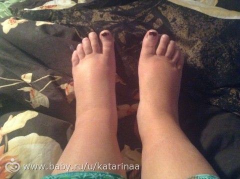 Тем, кто считает, что врачу виднее...