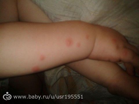 Вязаные шляпки - схемы вязания шляпок спицами Вязаные шляпки - схемы вязания шляпок спицами