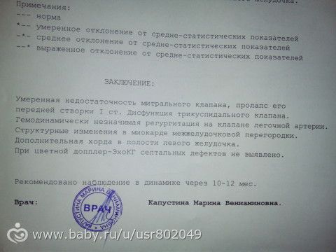 УЗИ сердца