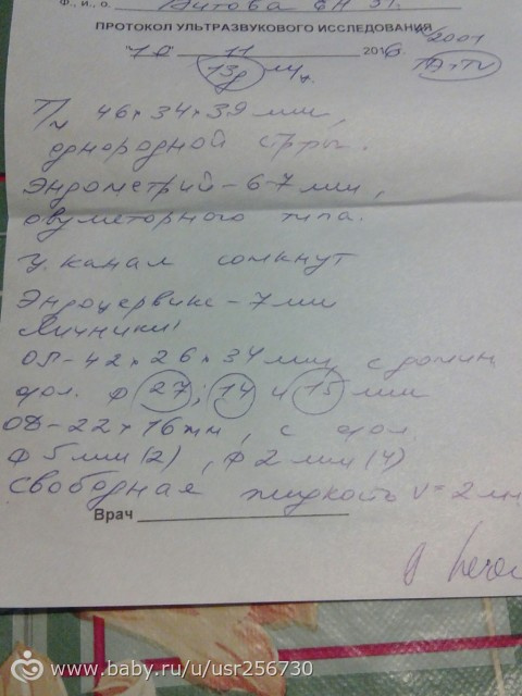 УЗИ. Фолликулометрия.