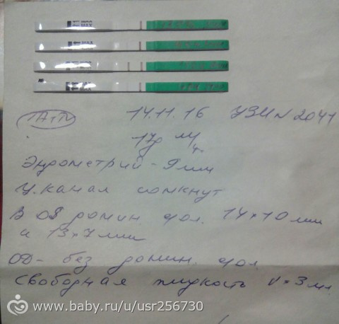 УЗИ. Фолликулометрия.