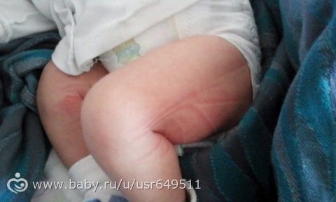 снова я) то есть мы)