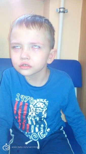 Роман Подхалюзин. ДЦП!