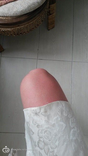 Жизнь по полсемьи.