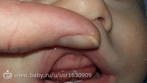 Зубы или еще нет?