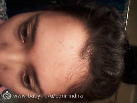 Что делать если есть вихор Что делать если есть вихор