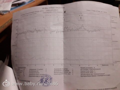 Третий триместр. 29-40 недель