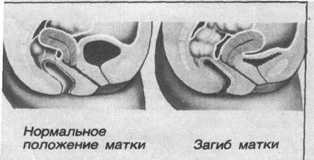Бешеную матку сложно удовлетворить Бешеную матку сложно удовлетворить