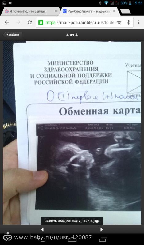 Мои вторые роды 26.12.2016 г.(фото)