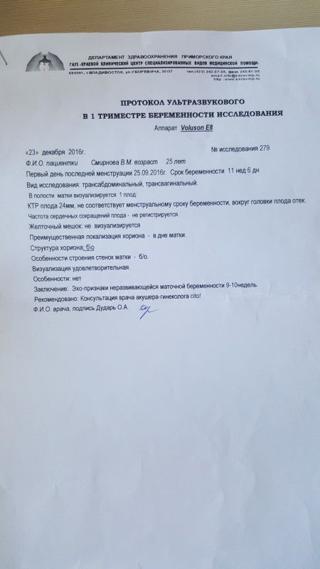 Убрала линеечку Убрала линеечку