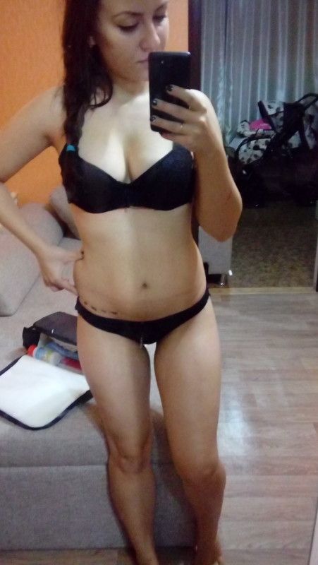 Спорт и похудение после КС Спорт и похудение после КС