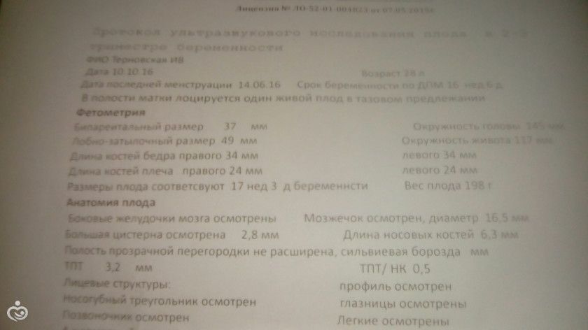 Мои 17 недель