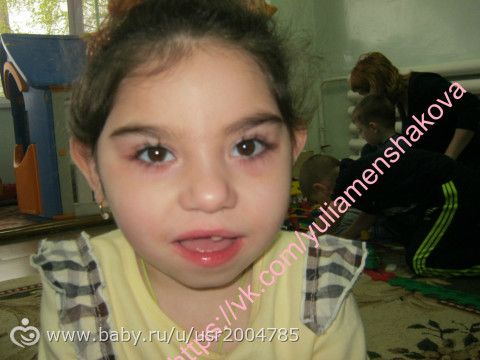 Новости от мамы на 10.08.2016 г.Юлия Меньшакова. ПОМОГИТЕ СПАСТИ ДЕТСТВО! Всего собрано:61876 рублей. Осталось собрать :222124 …