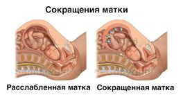 Можно ли но-шпу при беременности на ранних сроках Можно ли но-шпу при беременности на ранних сроках